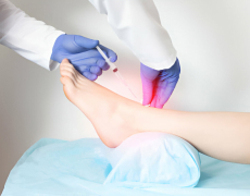  Neuropathy Treatment Center Southgate, FL